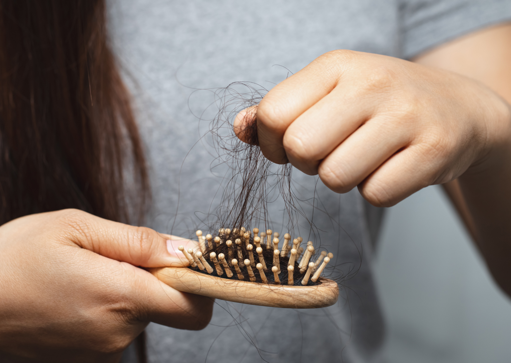 Consejos para prevenir la alopecia a temprana edad y mantener un cabello saludable